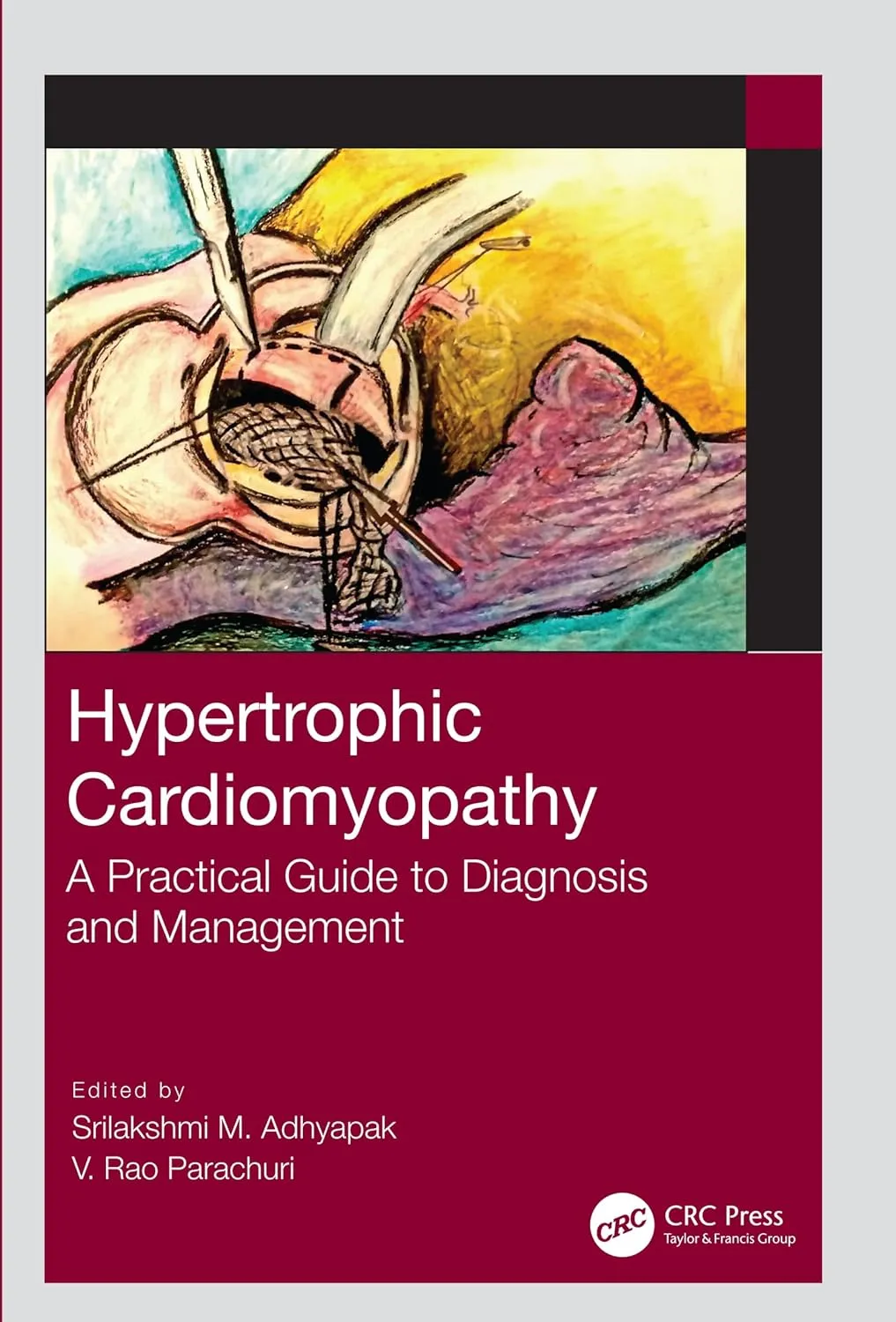 Hypertrophic Cardiomyopathy A Practical Guide To Diagnosis And Management | Paperback