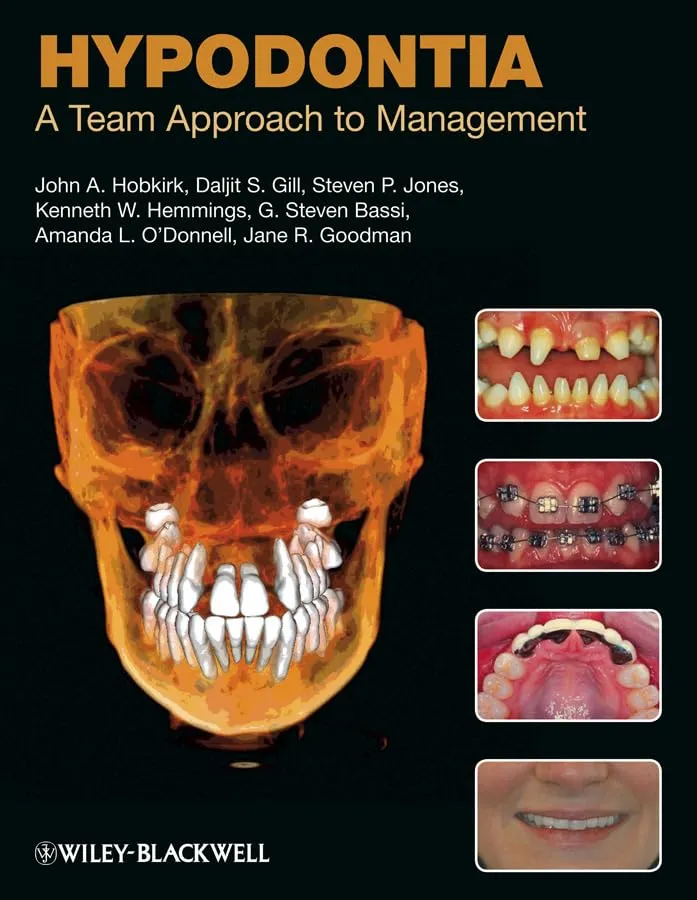 Hypodontia A Team Approach to management | Hardcover