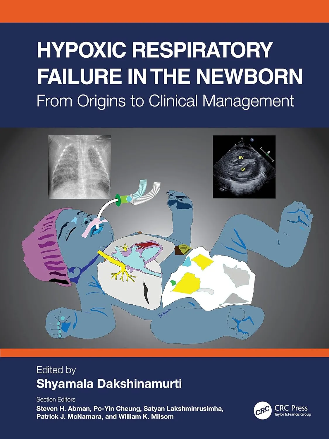 Hypoxic Respiratory Failure In The Newborn From Origins To Clinical Management | Hardcover