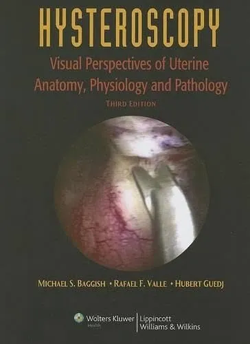 Hysteroscopy Visual Perspectives of Uterine Anatomy | Physiology and Pathology | Third Edition | Hardcover