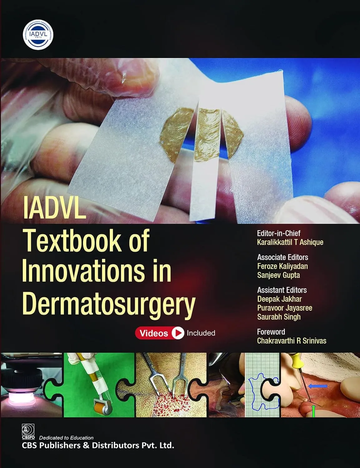Iadvl Textbook Of Innovations In Dermatosurgery | Hardcover