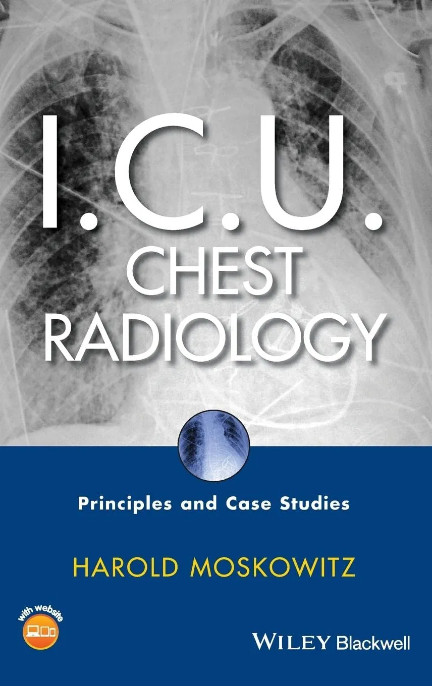 ICU Chest Radiology Principles and Case Studies | With CD