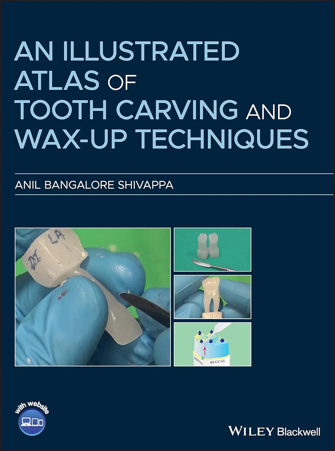 An Illustrated Atlas Of Tooth Carving And Wax Up Techniques | Hardcover