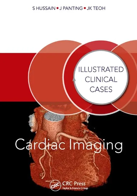Illustrated Clinical Cases Cardiac Imaging | Paperback