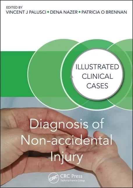Illustrated Clinical Cases Diagnosis of Non-accidental Injury | Paperback