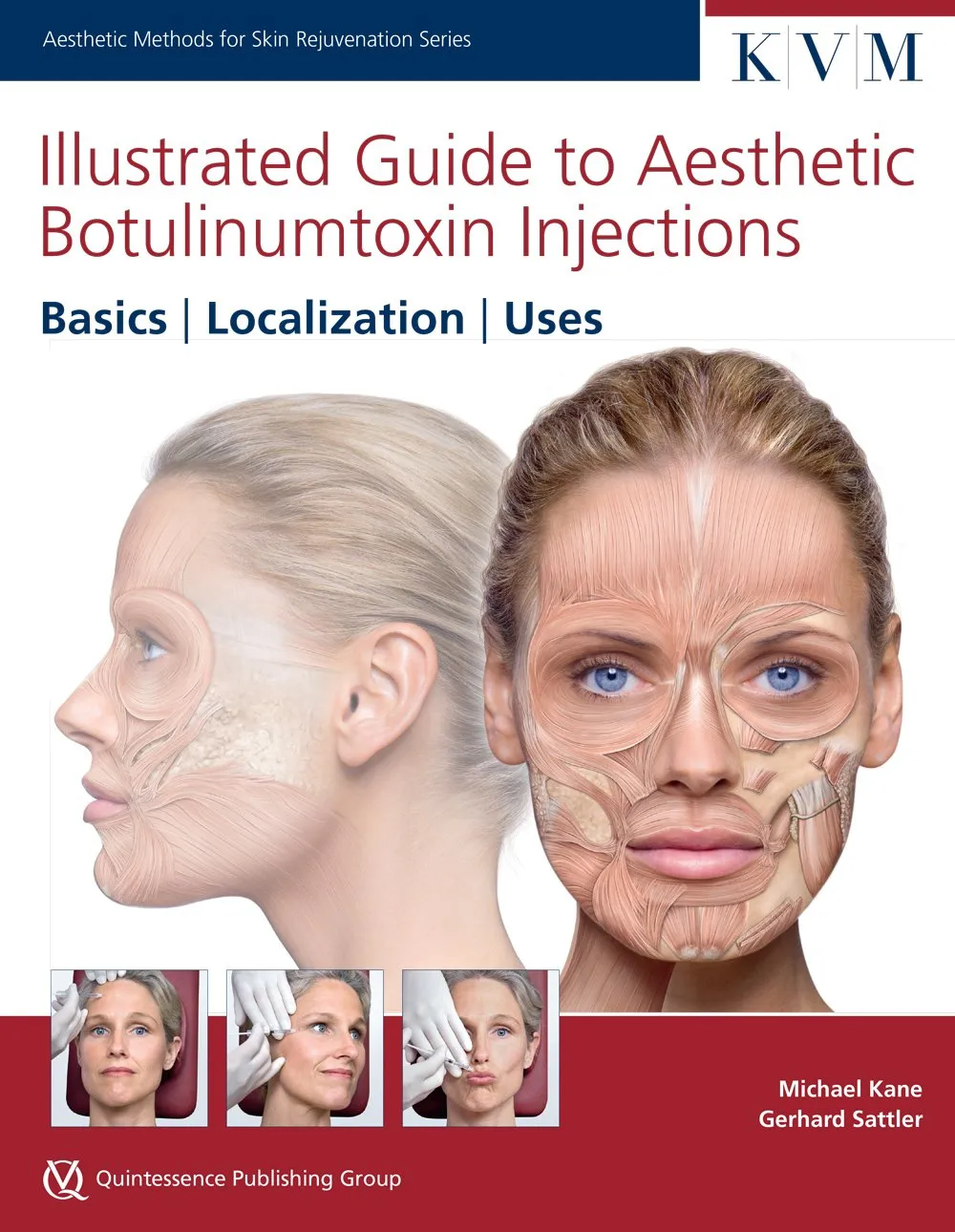 Illustrated Guide to Aesthetic Botulinumtoxin Injections Basics | Localization | Uses | Hardcover