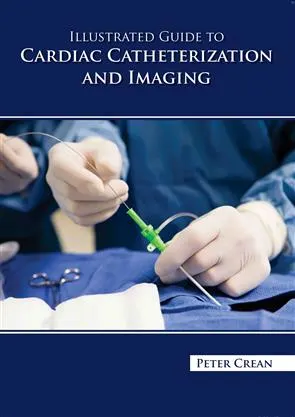 Illustrated Guide To Cardiac Catheterization And Imaging | Hardcover