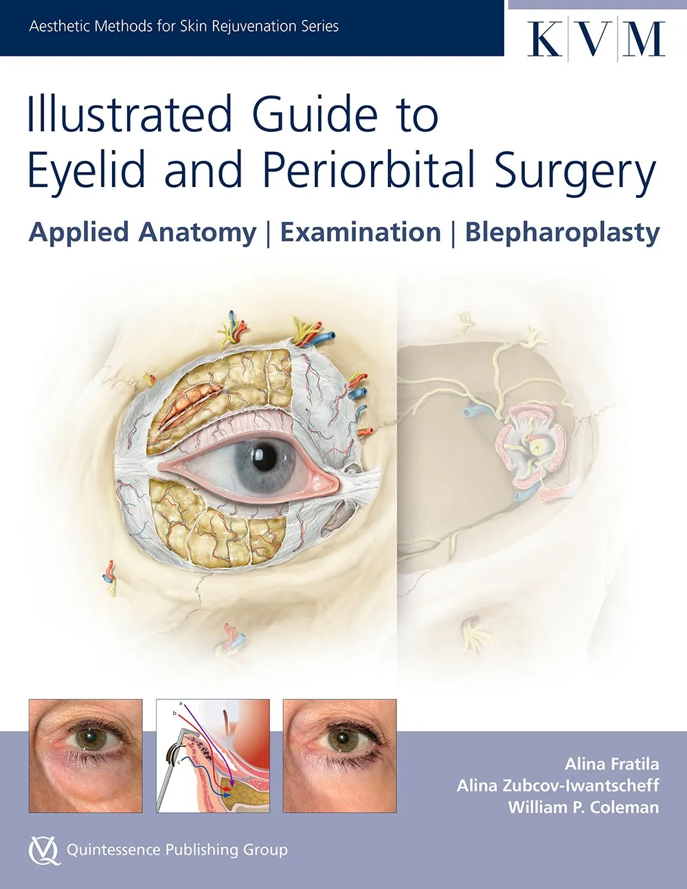 Illustrated Guide to Eyelid and Periorbital Surgery Applied Anatomy | Examination | Blepharoplasty | Hardcover