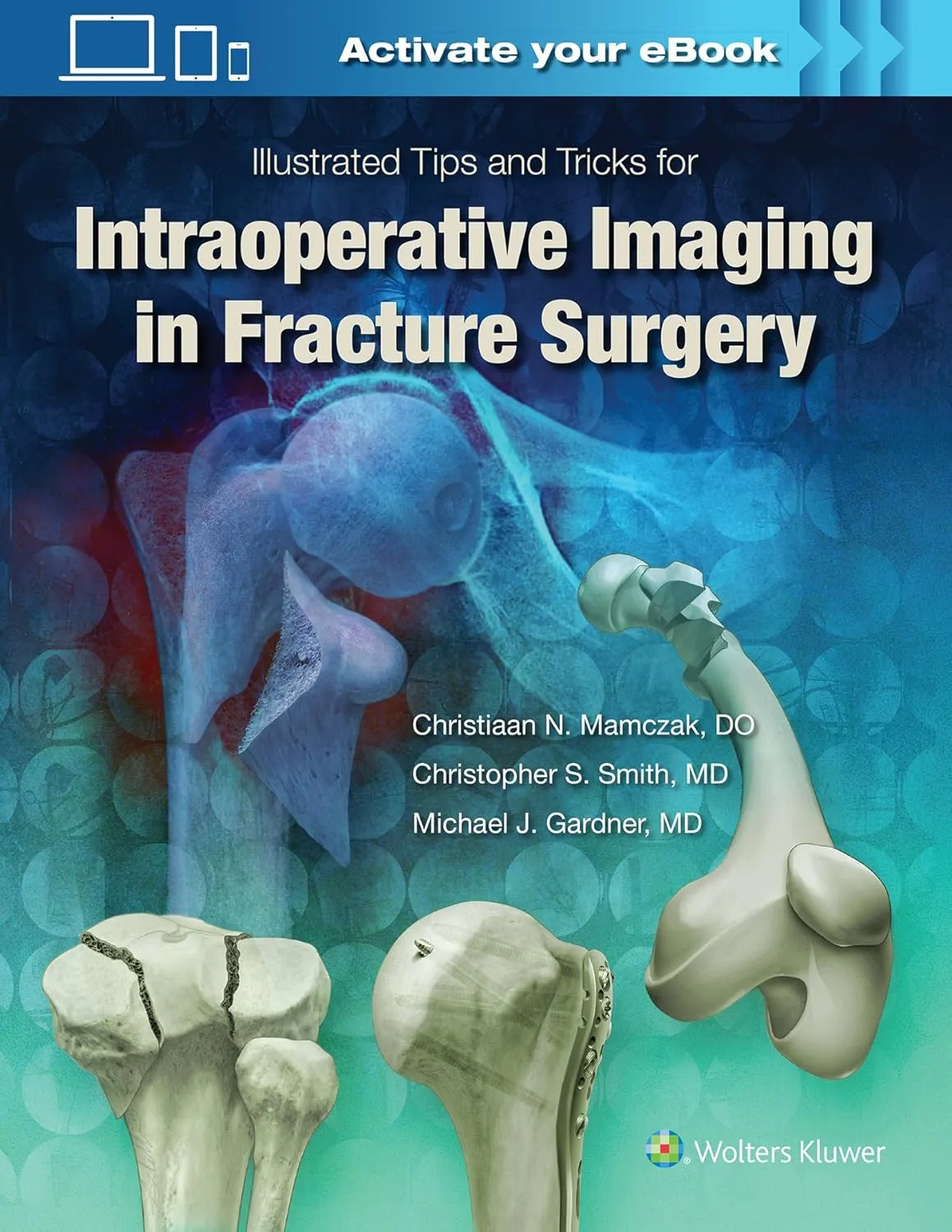 Illustrated Tips and Tricks for Intraoperative Imaging in Fracture Surgery | Hardcover