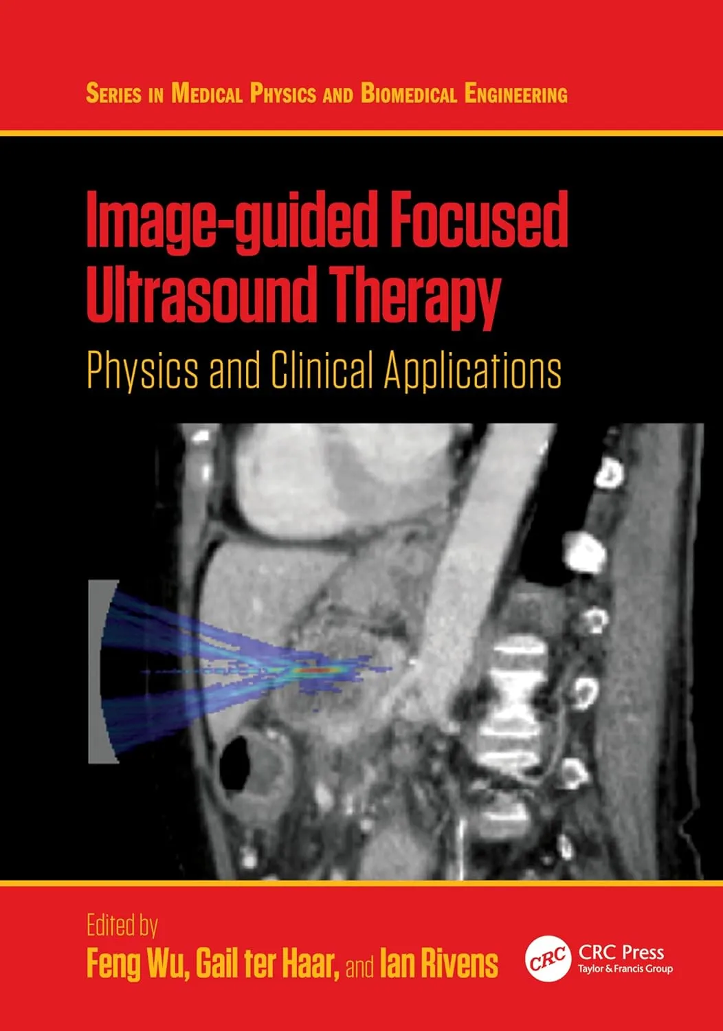 Image Guided Focused Ultrasound Therapy Physics And Clinical Applications | Hardcover