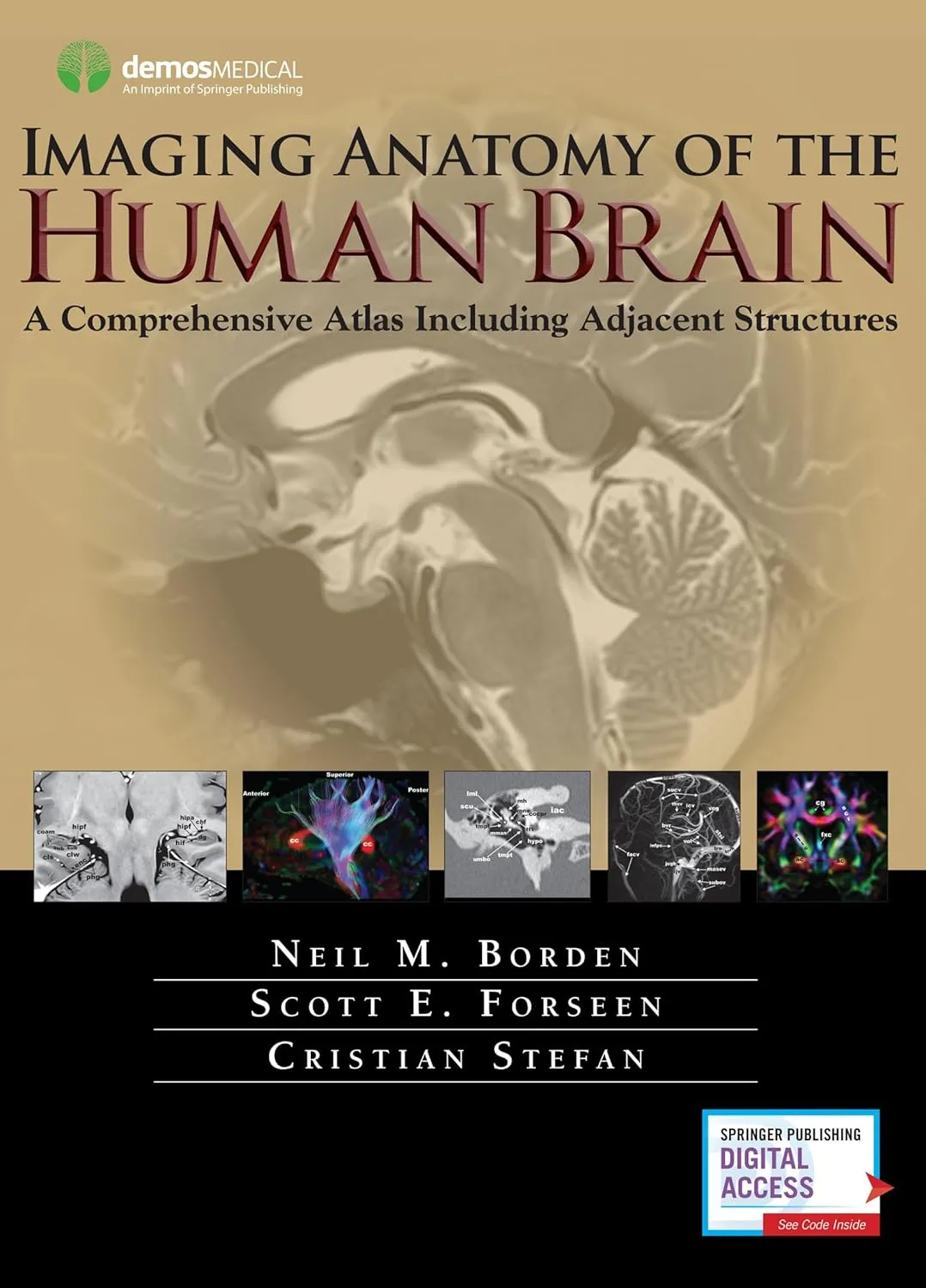 Imaging Anatomy of the Human Brain | Hardcover