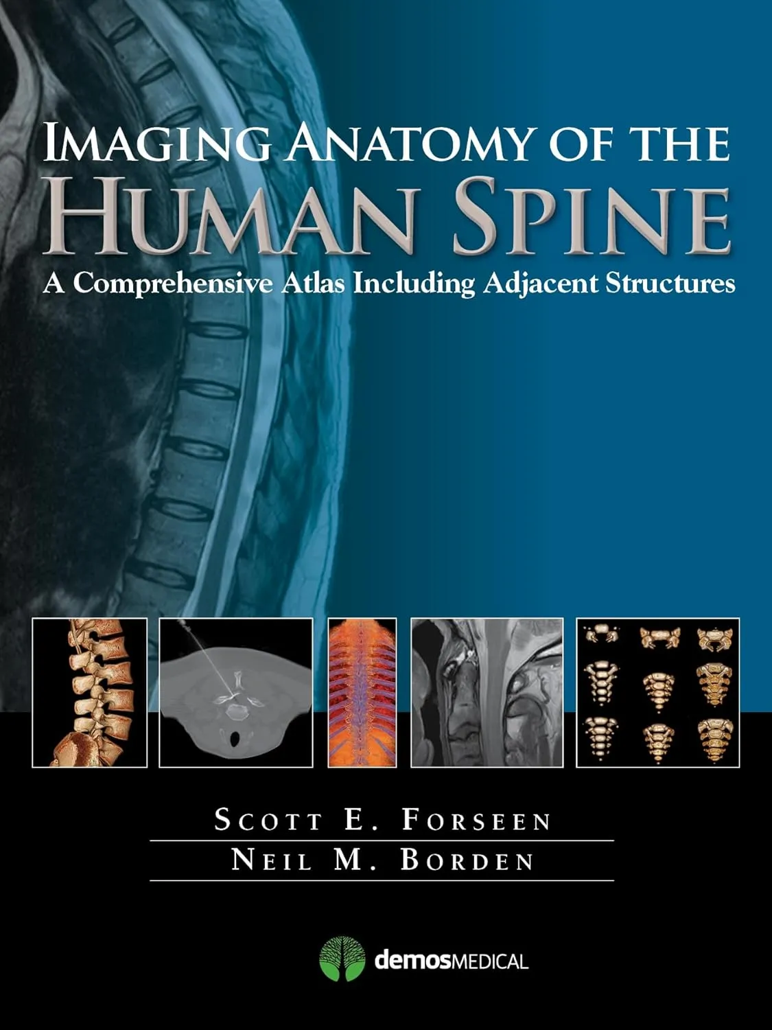 Imaging Anatomy of the Human Spine | Hardcover