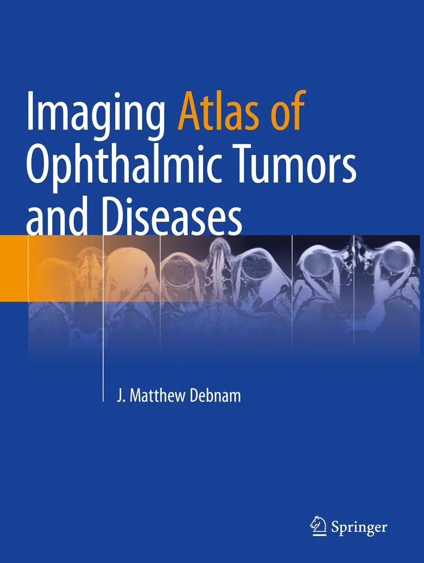 Imaging Atlas Of Ophthalmic Tumors And Diseases | Paperback
