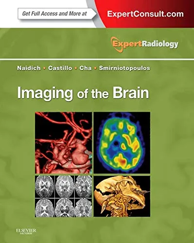 Imaging of the Brain | Hardcover