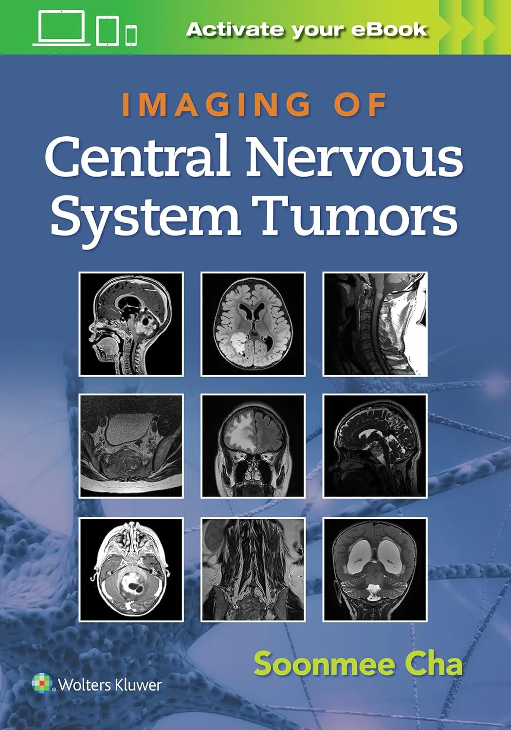 Imaging of Central Nervous System Tumors With Access Code | Paperback