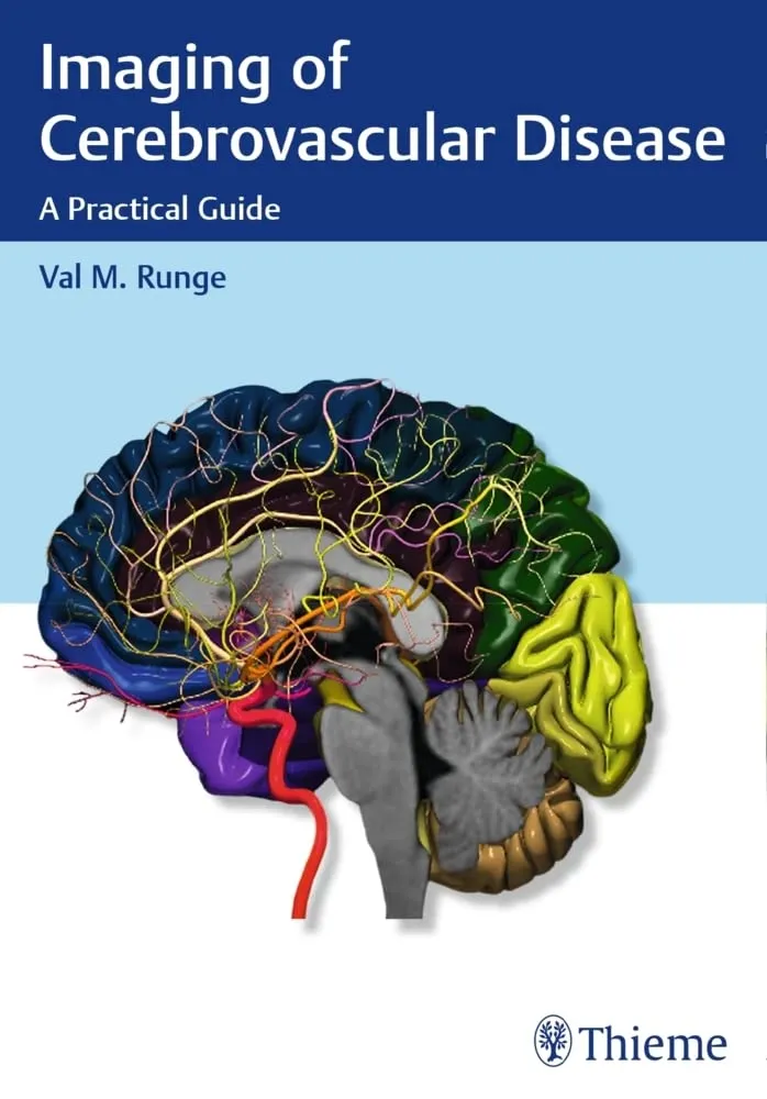 Imaging of Cerebrovascular Disease A Practical Guide | Paperback