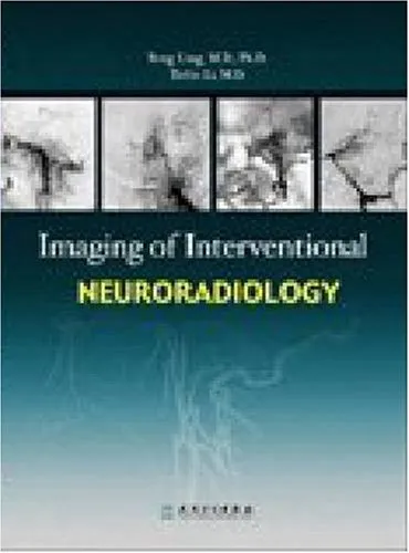 Imaging of Interventional Neuroradiology | Hardcover
