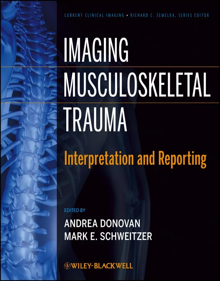 Imaging Musculoskeletal Trauma | Hardcover