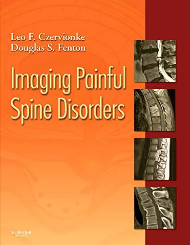 Imaging Painful Spine Disorders | Hardcover
