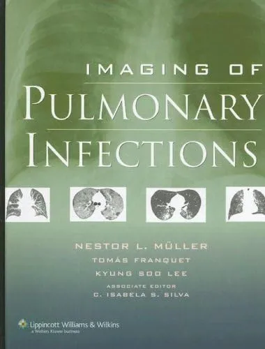 Imaging Of Pulmonary Infections | Hardcover