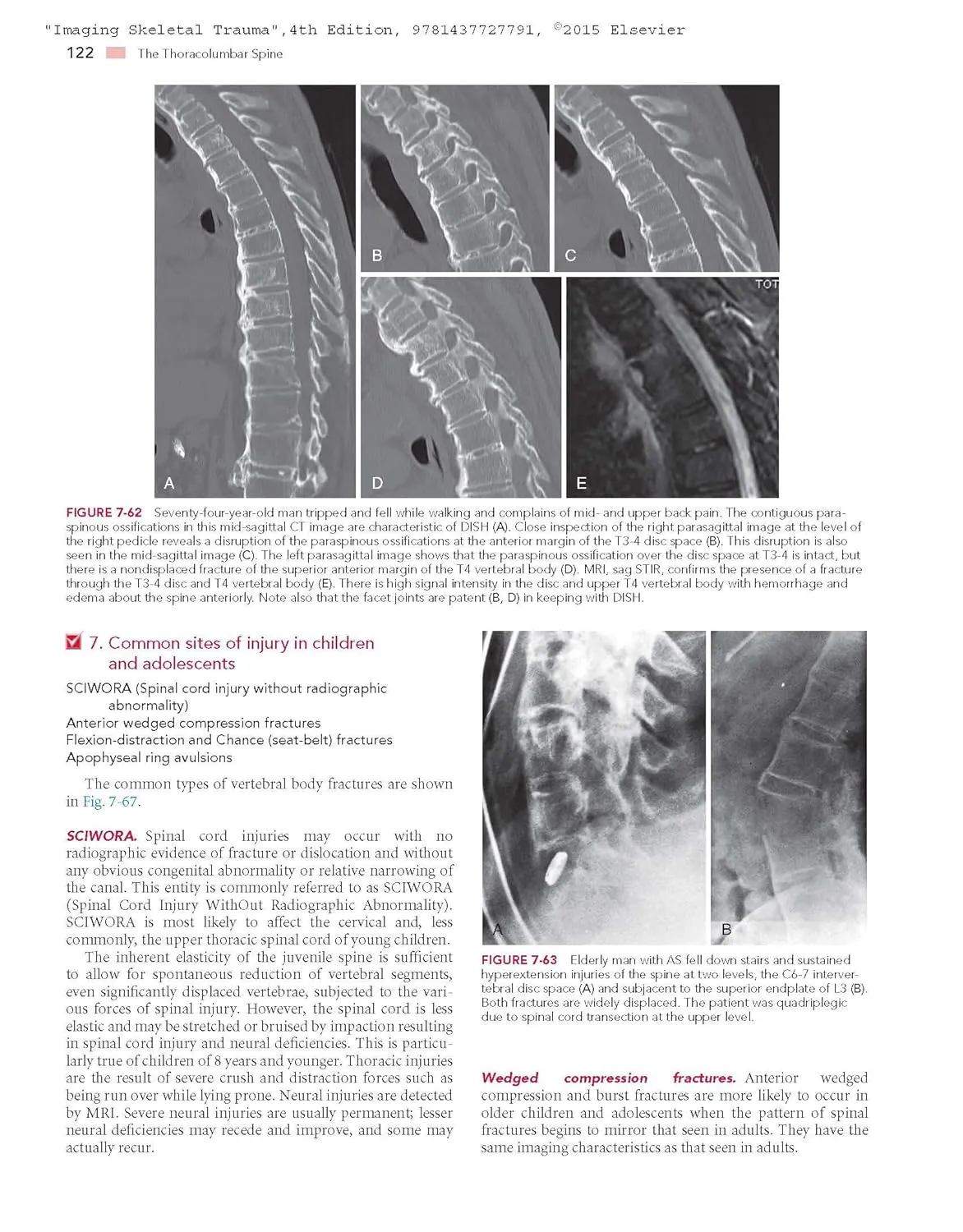 Imaging Skeletal Trauma | 4th Edition | Hardcover