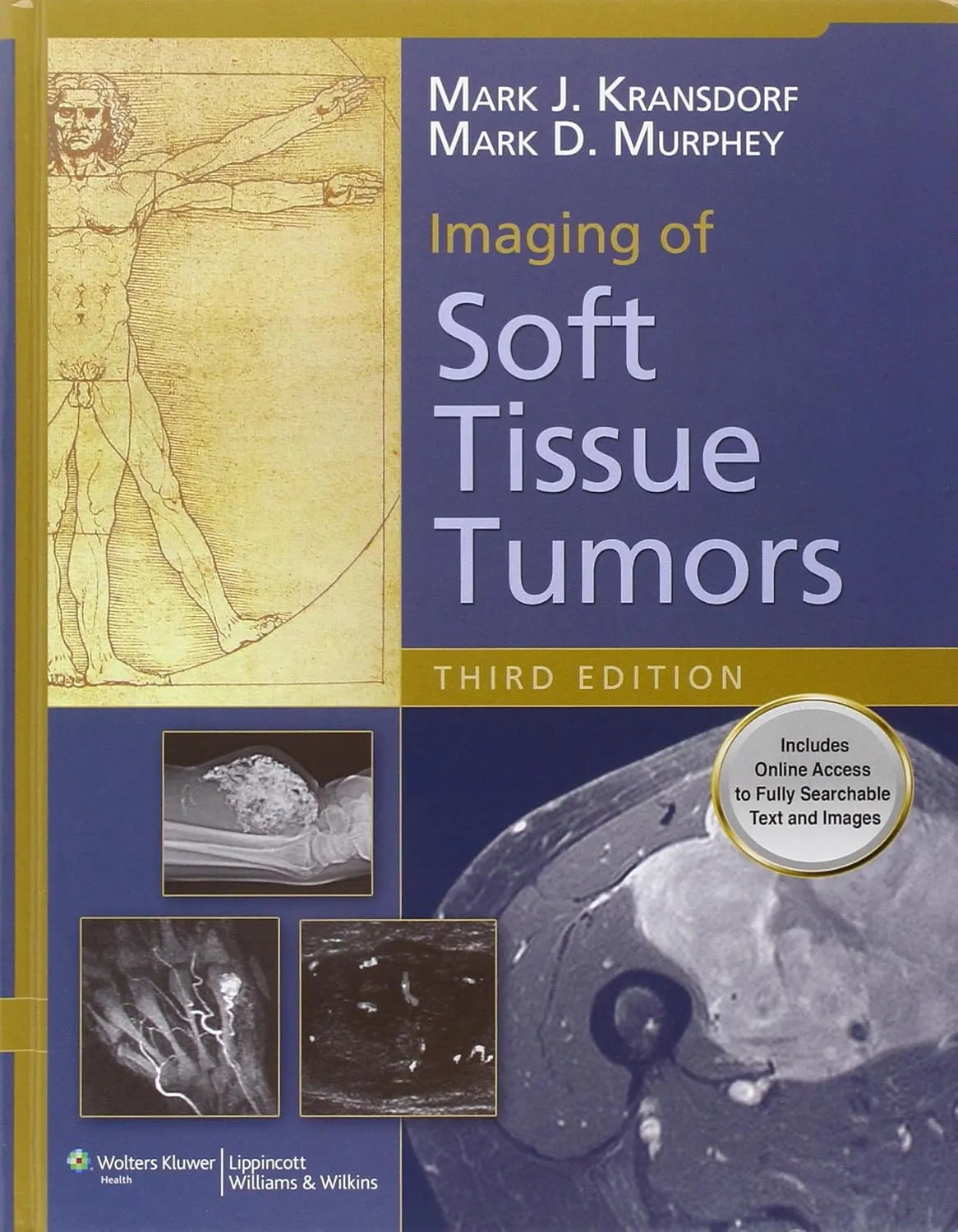 Imaging of Soft Tissue Tumors | Third Edition | Hardcover