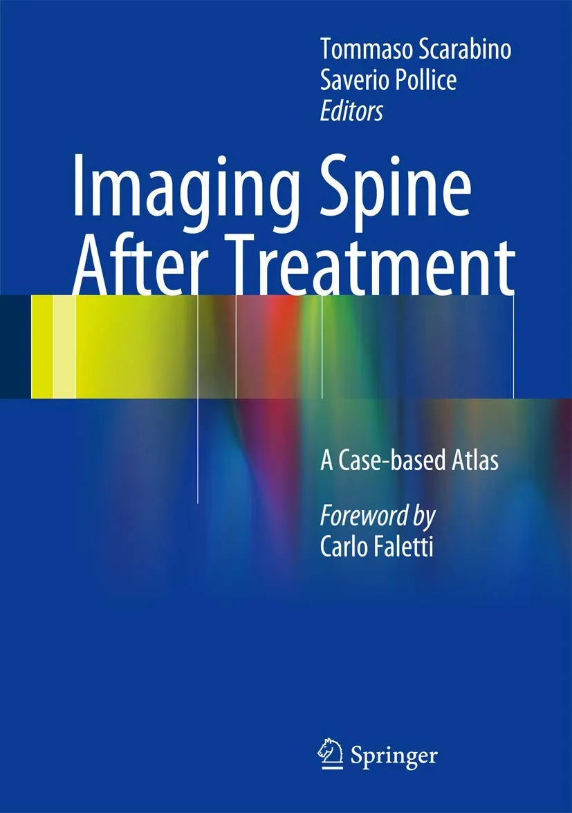 Imaging Spine After Treatment | Hardcover