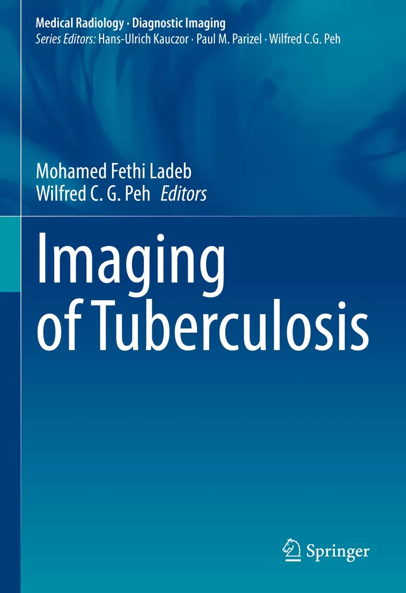 Imaging Of Tuberculosis | Hardcover