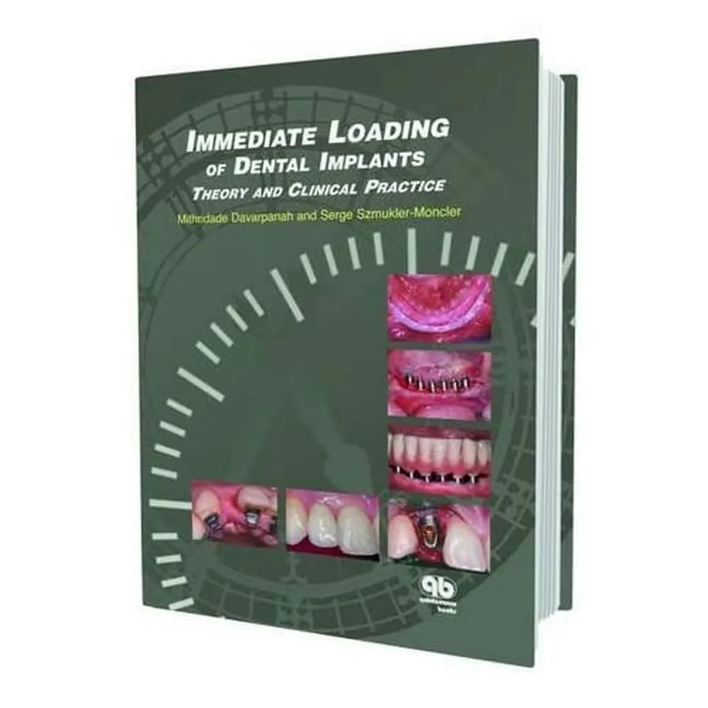Immediate Loading of Dental Implants | Hardcover