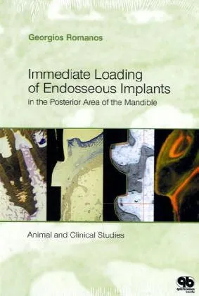 Immediate Loading of Endosseous Implants in the Posterior Area of the Mandible Animal and Clinical Studies | Hardcover