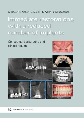 Immediate Restorations with a Reduced Number of Implants Conceptual Background and Clinical Results | Hardcover