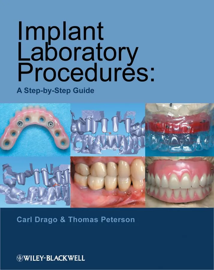 Implant Laboratory Procedures A Step-by-Step Guide | Paperback