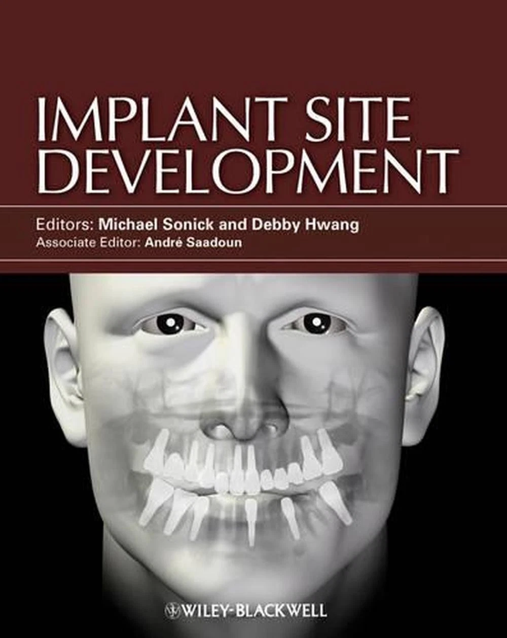 Implant Site Development | Hardcover