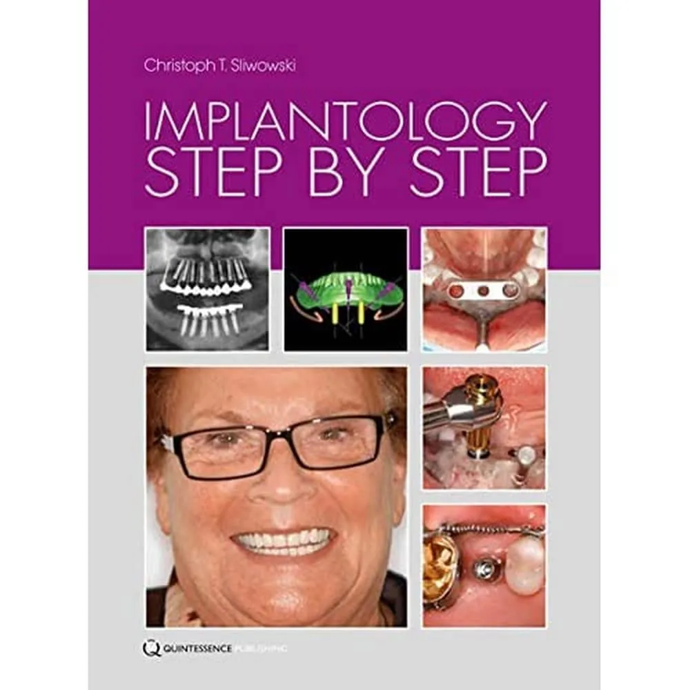 Implantology Step by Step | Hardcover