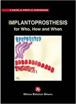 Implantoprosthesis for Who | How and When | Hardcover