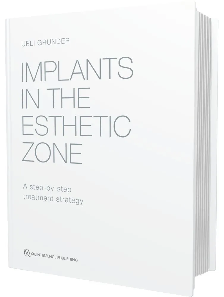 Implants in the Esthetic Zone | Hardcover