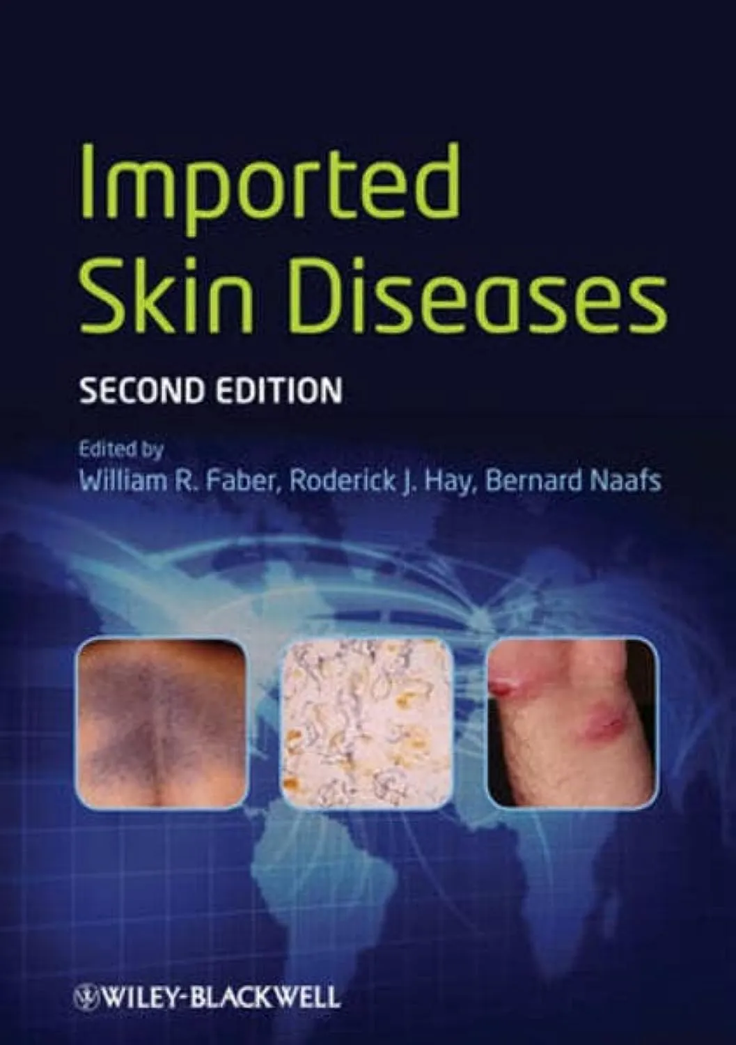 Imported Skin Diseases | 2nd Edition | Hardcover