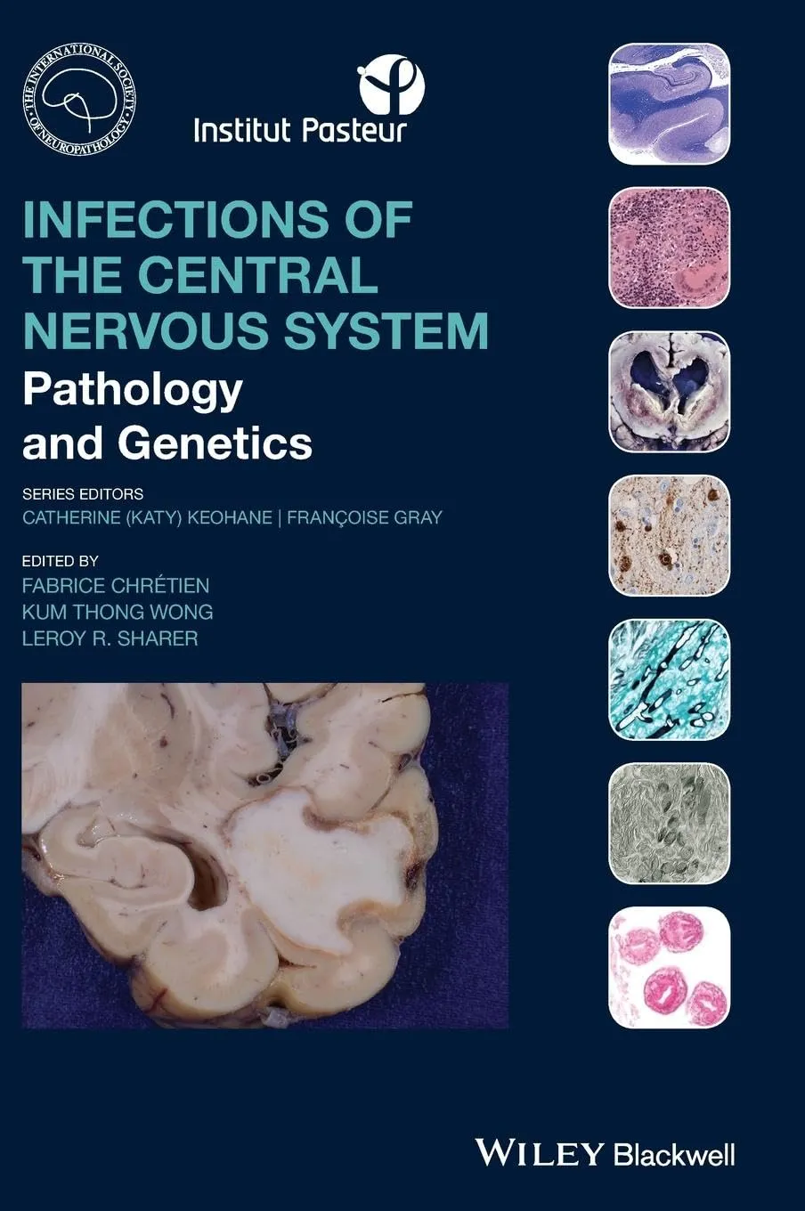 Infections Of The Central Nervous System Pathology And Genetics | Hardcover