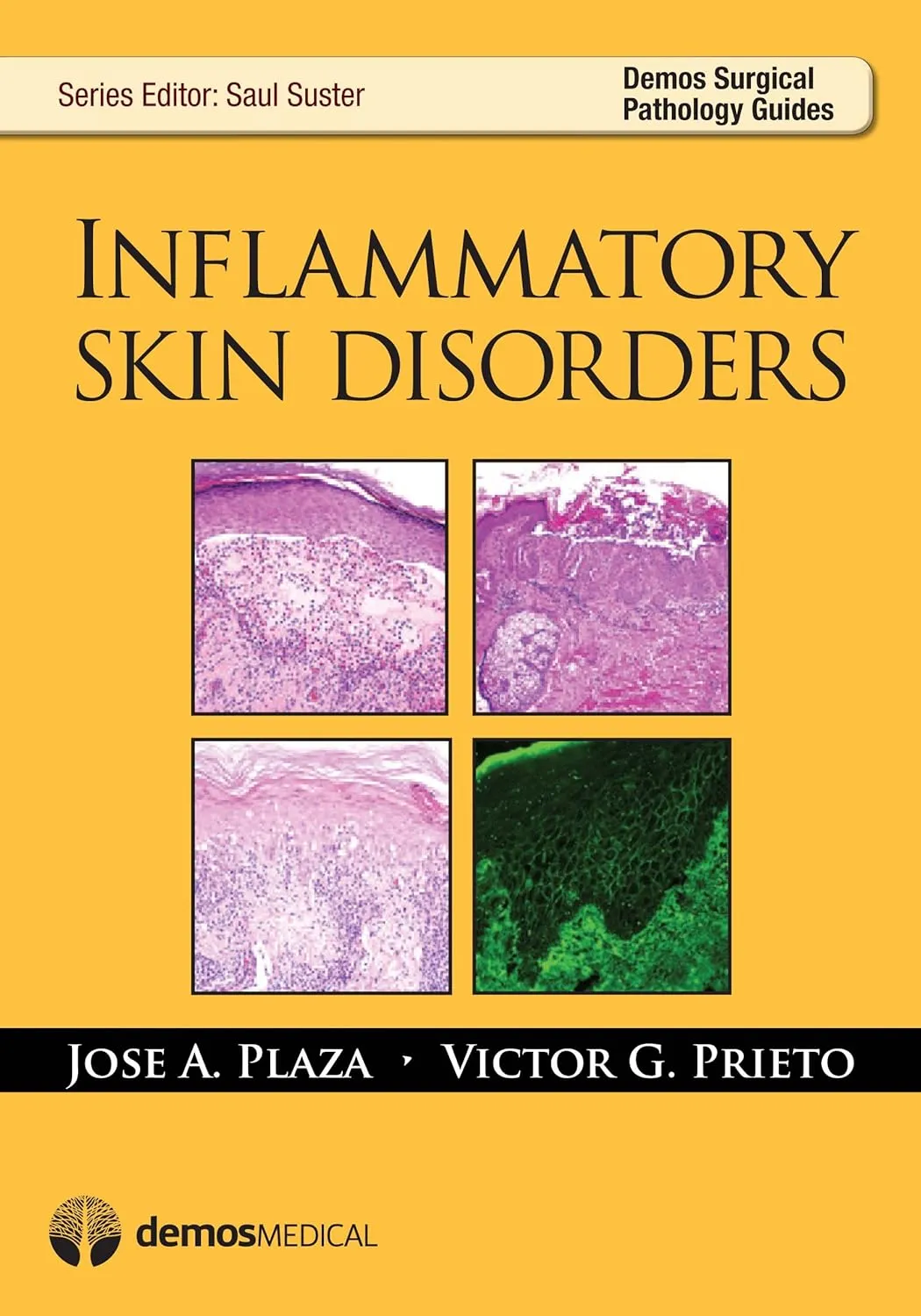 Inflammatory Skin Disorders | Paperback