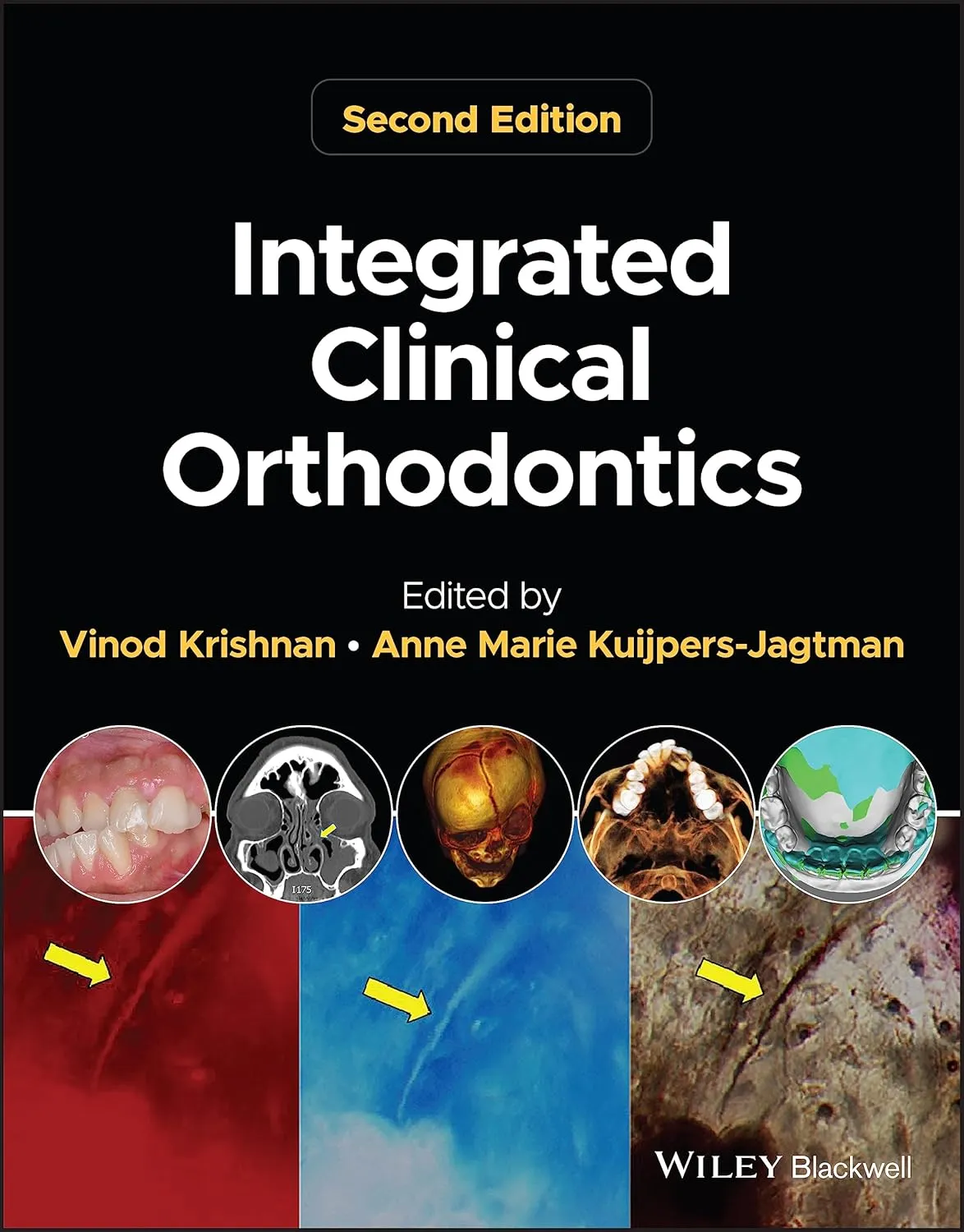 Integrated Clinical Orthodontics 2nd Editiond | Hardcover