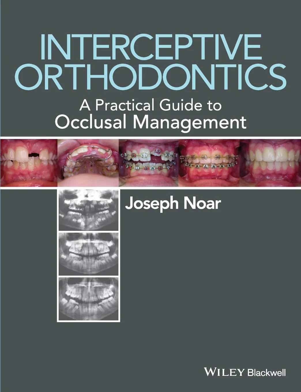 Interceptive Orthodontics A Practical Guide to Occlusal Management | Paperback
