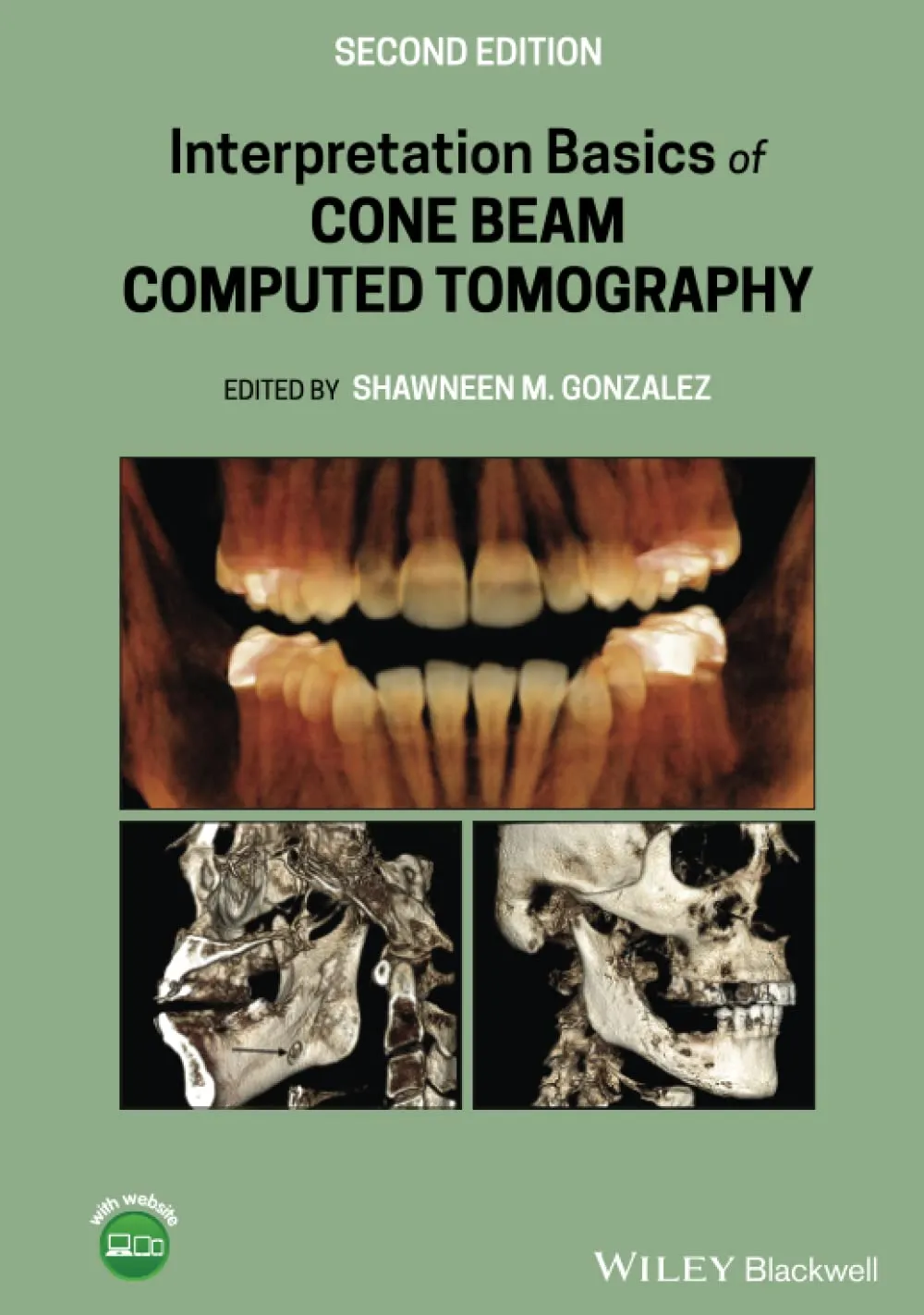 Interpretation Basics Of Cone Beam Computed Tomography 2nd Edition | Hardcover
