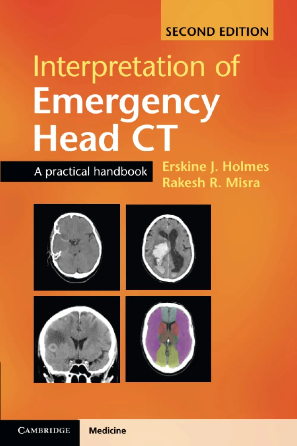 Interpretation of Emergency Head CT | 2nd Edition | Paperback