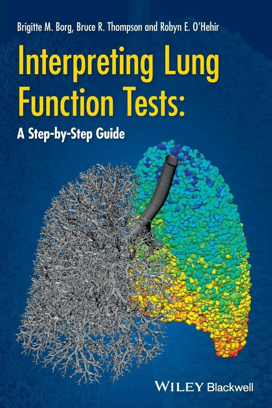 Interpreting Lung Function Tests A Step-by-Step Guide | Paperback