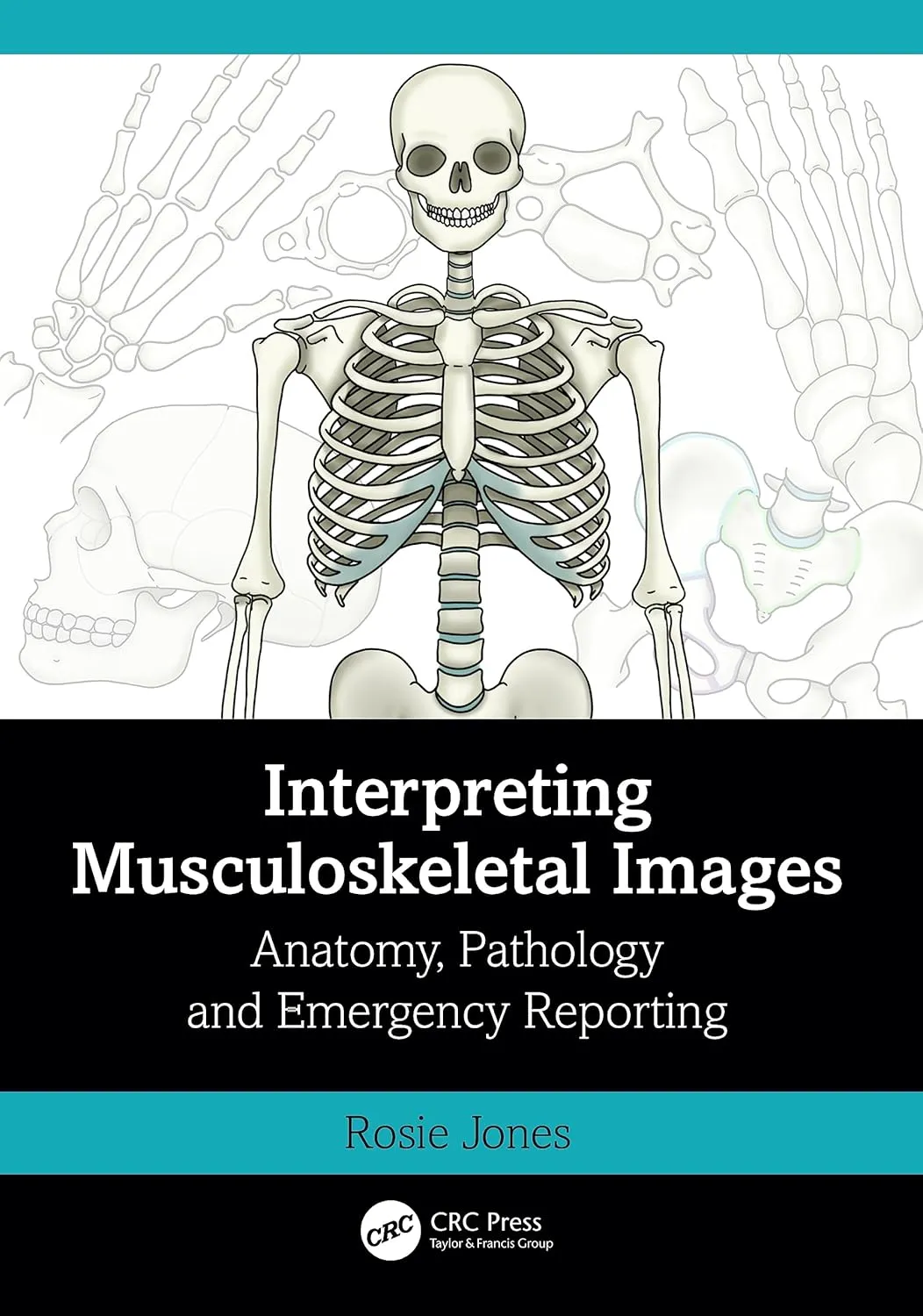 Interpreting Musculoskeletal Images Anatomy Pathology And Emergency Reporting | Paperback