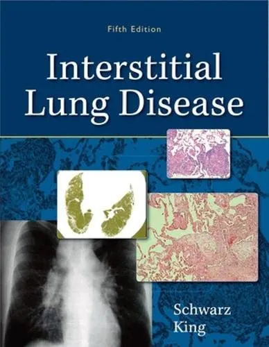 Interstitial Lung Disease | 5th Edition | Hardcover