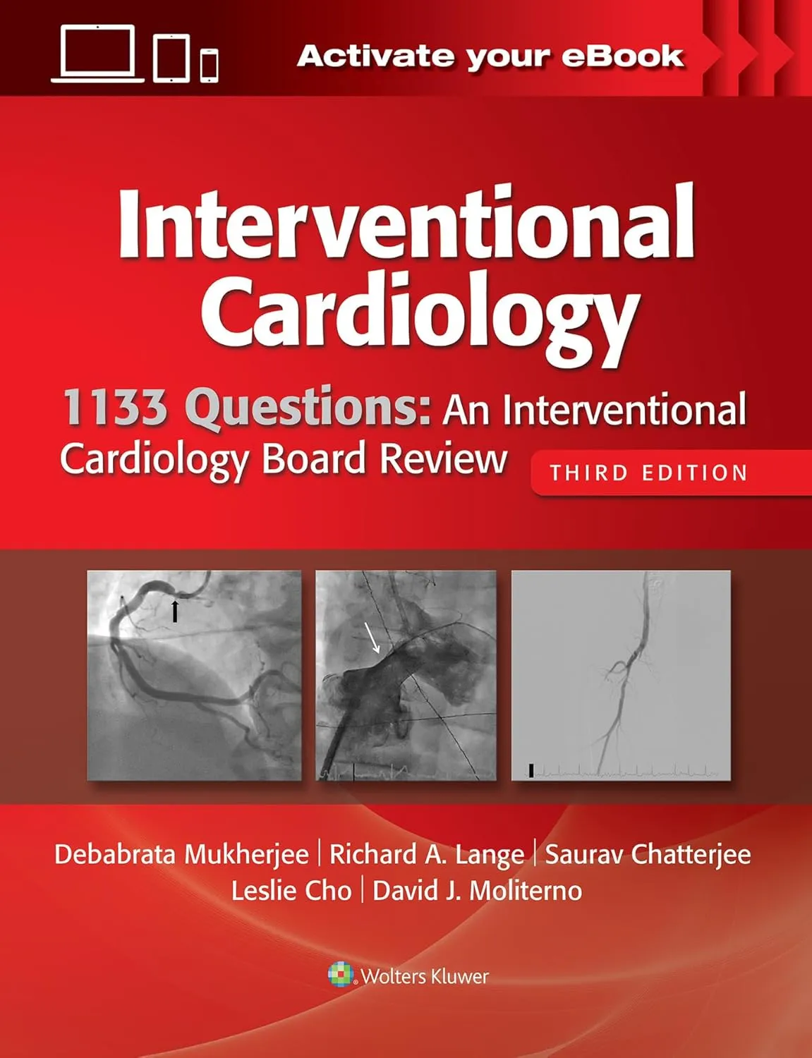 Interventional Cardiology 1133 Questions An Interventional Cardiology Board Review | Third Edition | Paperback