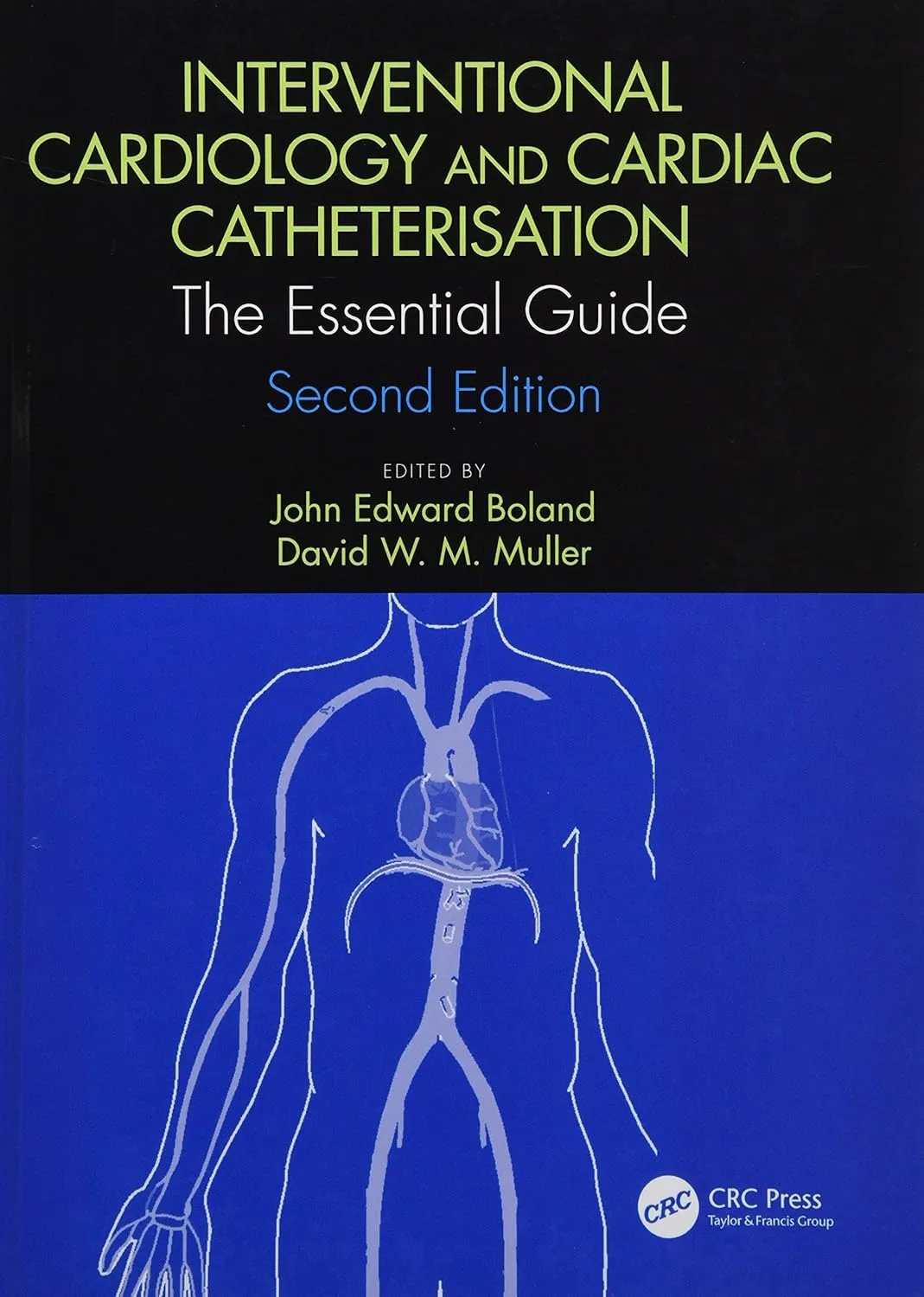 Interventional Cardiology and Cardiac Catheterisation The Essential Guide | 2nd Edition | Hardcover