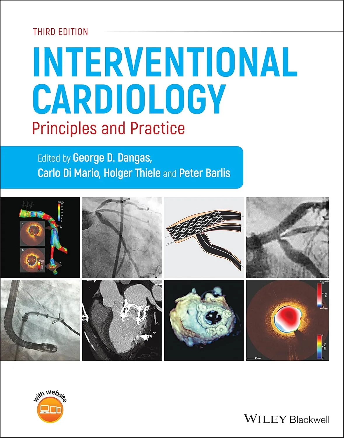 Interventional Cardiology Principles And Practice Third Edition | Hardcover