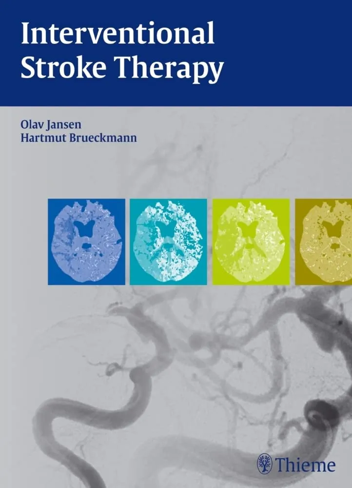 Interventional Stroke Therapy | Hardcover